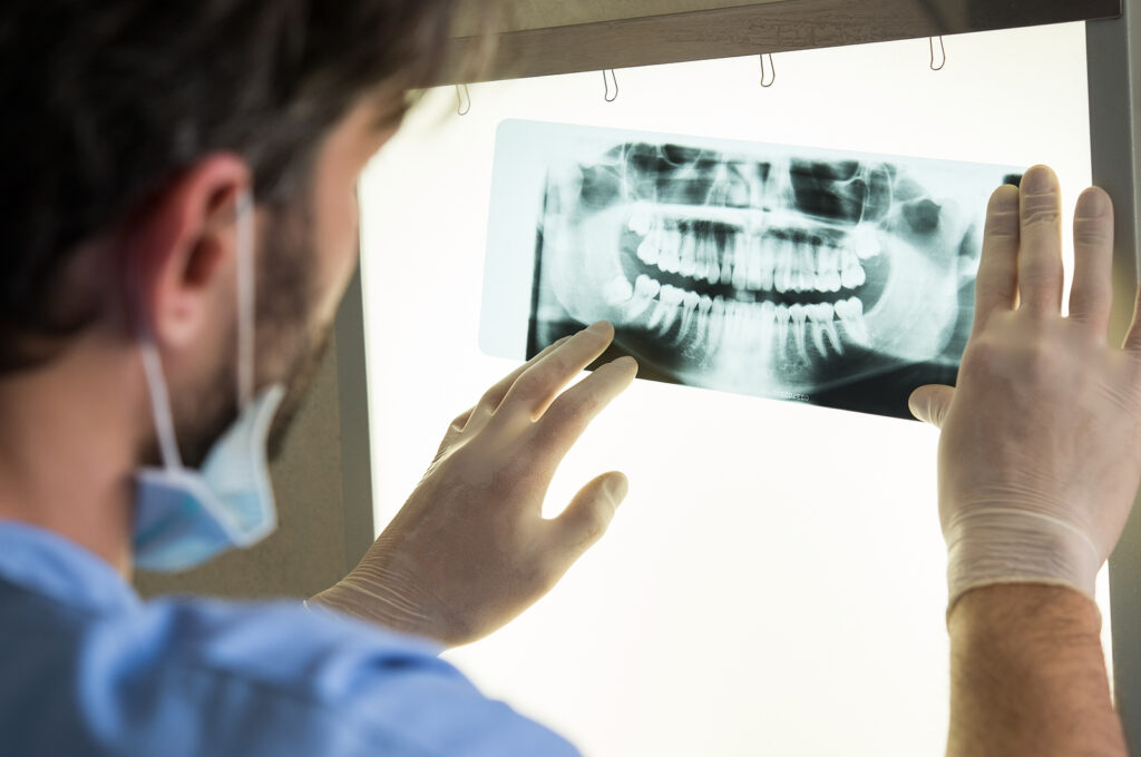 implants dentaire VMR